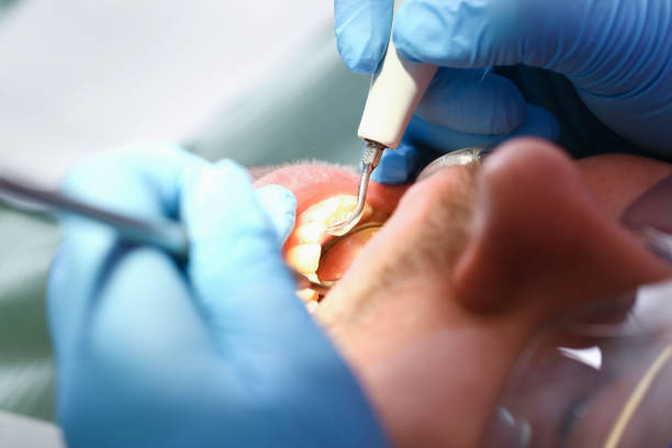 Best 24-Hour Emergency Dentist in Fredericksburg, TX