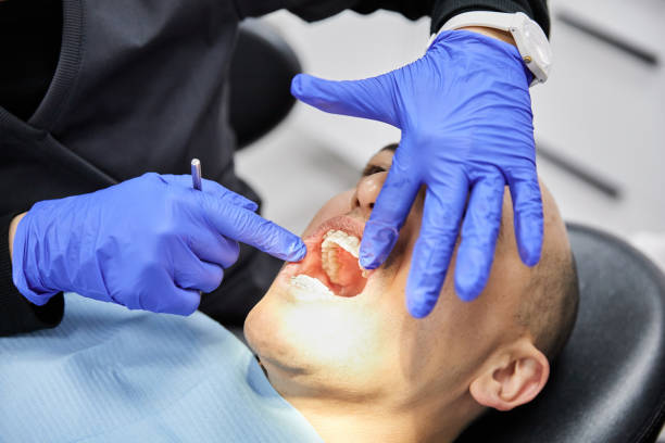 Best Emergency Dentist for Knocked-Out Tooth in Fredericksburg, TX