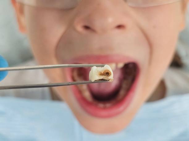 Best Weekend Emergency Dentist in Fredericksburg, TX